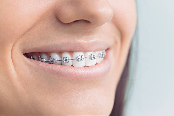 Best Wisdom Tooth Removal  in French Lick, IN